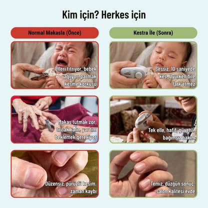 Kestra® Tırnak Kesme Aleti